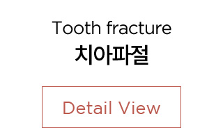 치아파절