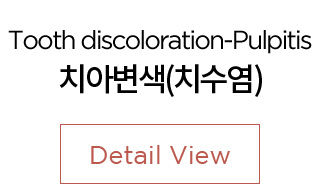 치아변색